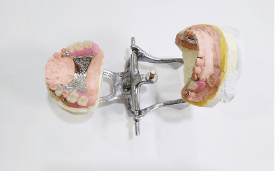 Prosthodontic dental model on display