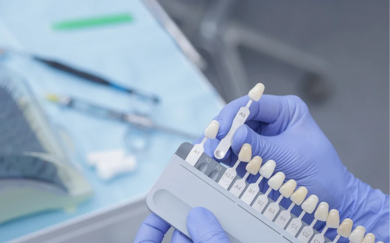 Dental shade guide held by gloved hands