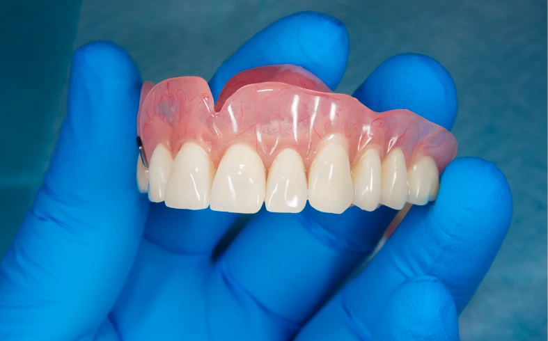 Dental prosthetics in blue-gloved hands