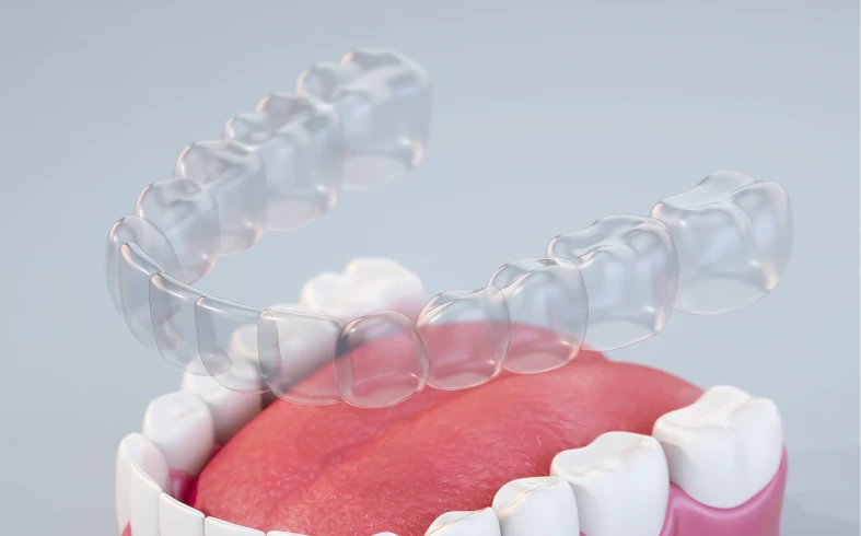 Transparent dental aligner demonstration